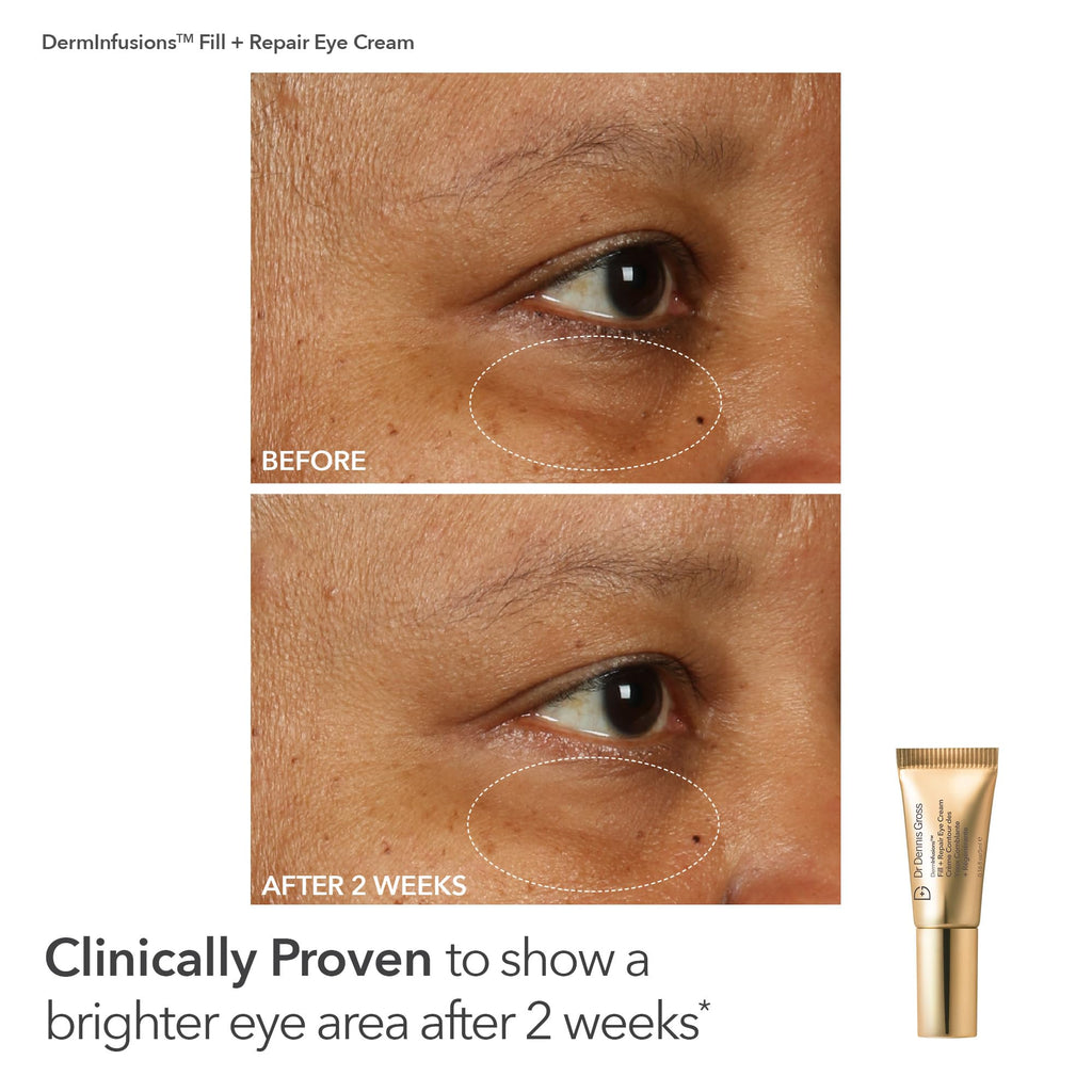 Dr Dennis Gross Fill, Plump & Firm Kit | DermInfusions Hyaluronic Serum, Eye & Lip