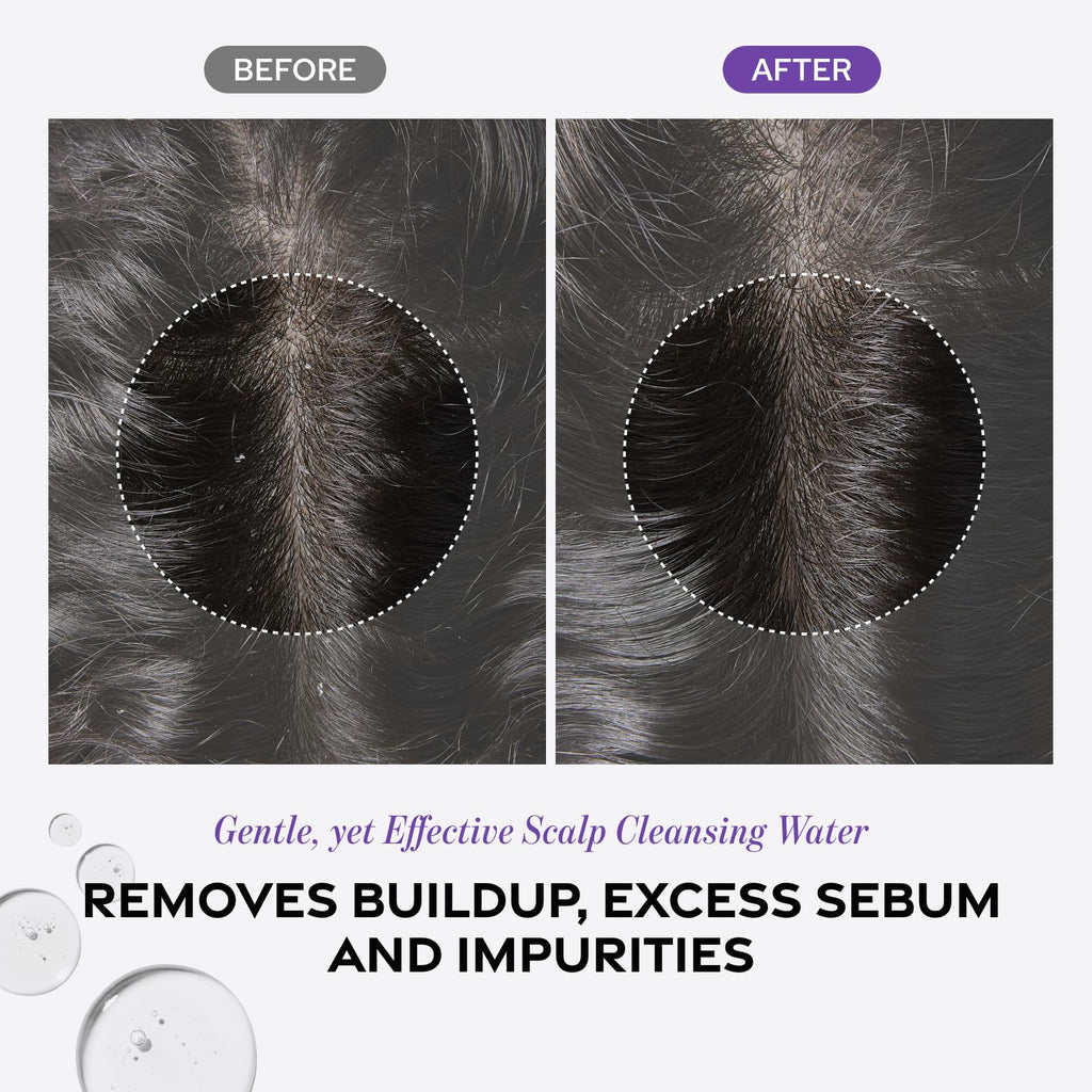 Dr. Groot Scalp Revitalizing Solution – Detox Water for Scalp Wellness