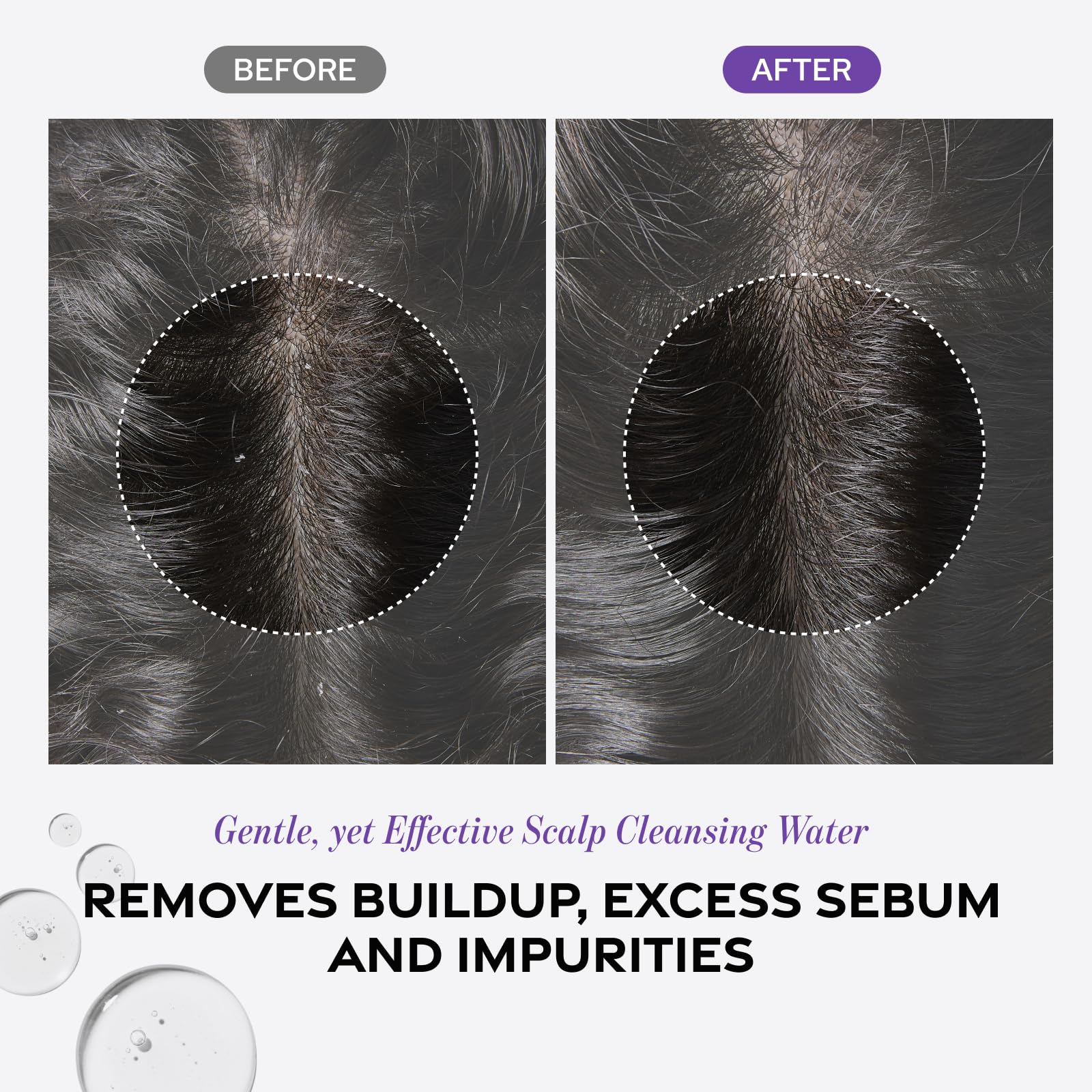 Dr. Groot Scalp Revitalizing Solution – Detox Water for Scalp Wellness