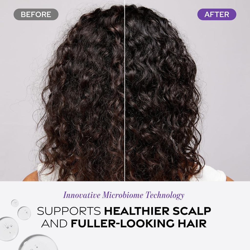 Dr. Groot Scalp Revitalizing Solution – Detox Water for Scalp Wellness
