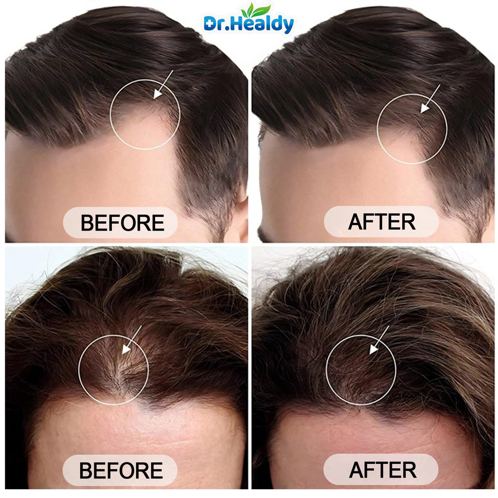Dr. Healdy Batana Oil Shampoo for Hair Growth – Sulfate-Free, All Hair Types