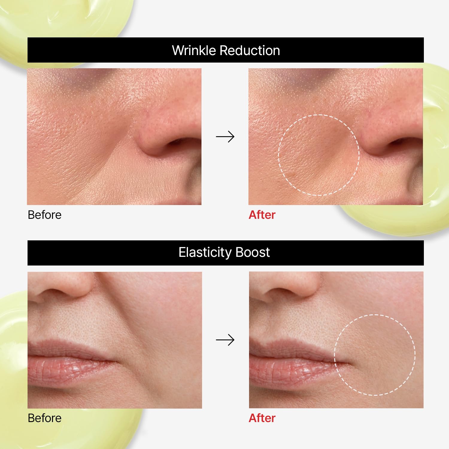 Dr.Different VITALIFT-A Forte Retinal 0.1% – Intensive Anti-Aging Cream for Wrinkle Reduction & Firming