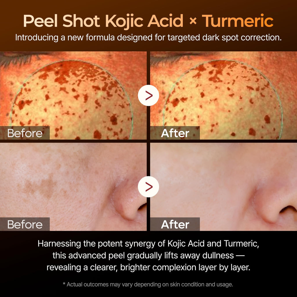 Dr.Melaxin Peel Shot Kojic Acid Turmeric Serum 80ml | Dark Spot Care & Exfoliation