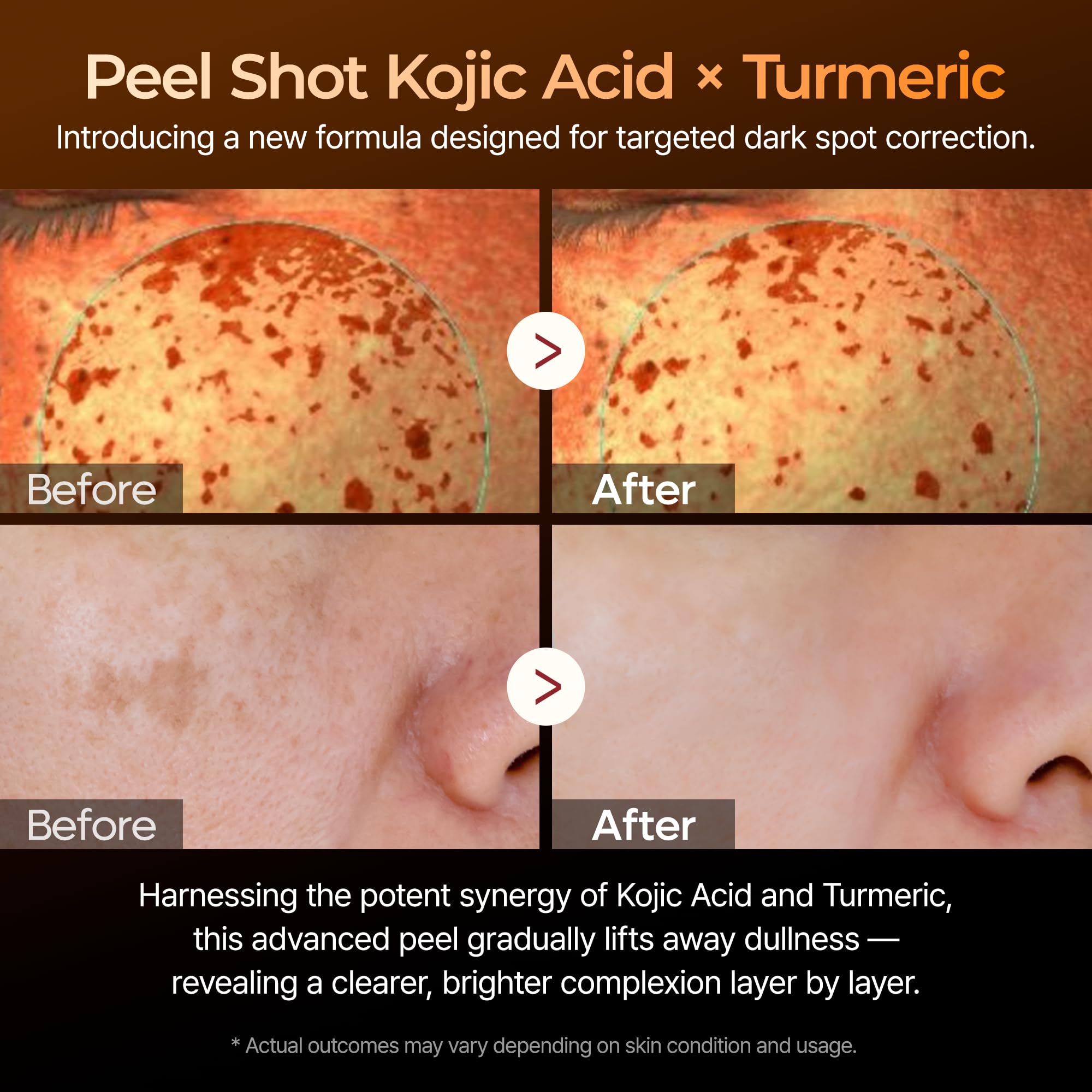Dr.Melaxin Peel Shot Kojic Acid Turmeric Serum 80ml | Dark Spot Care & Exfoliation