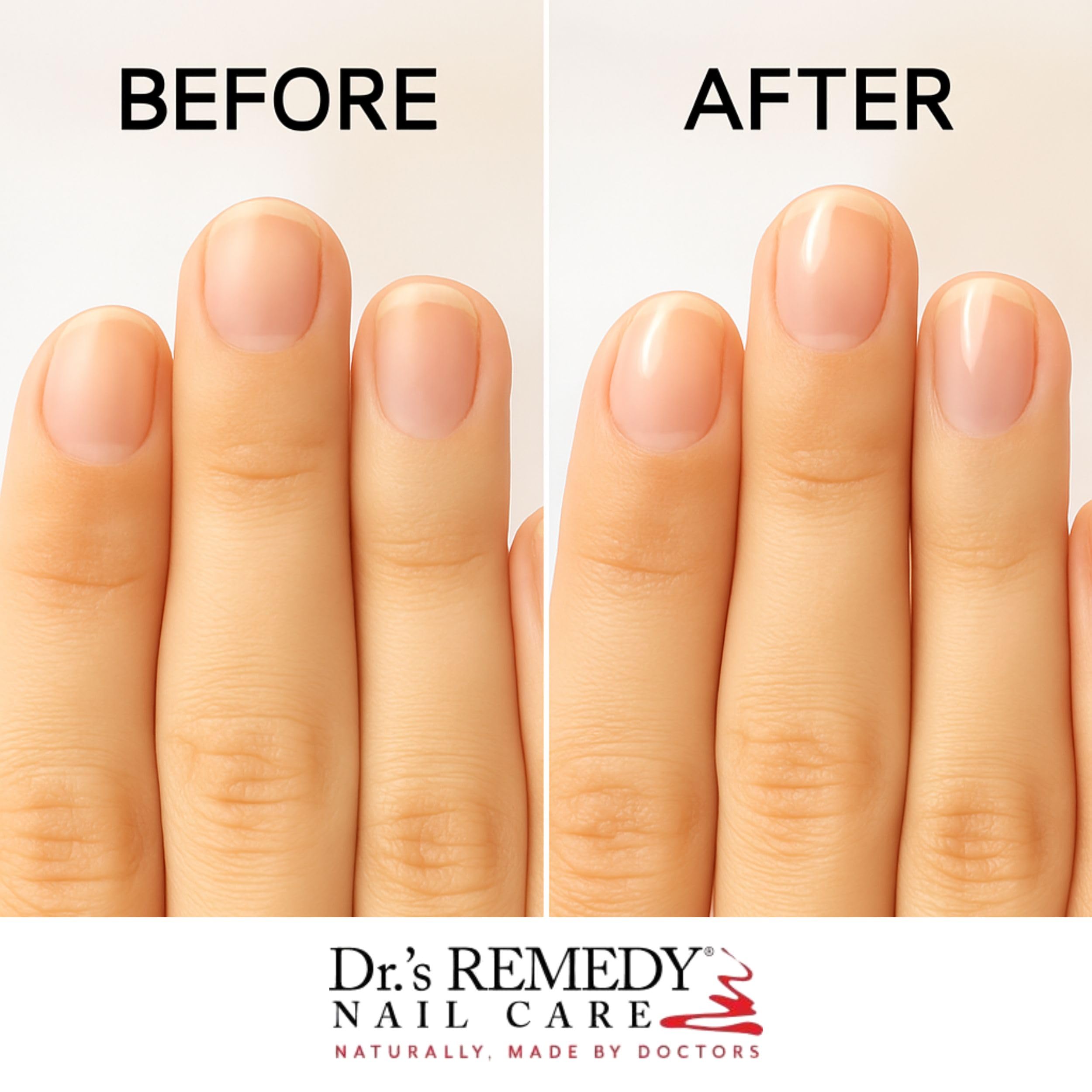 Dr.'s Remedy 3 Pack Nail Polish Treatment Kit - Nourishing New Beginnings Gift Set - Non-Toxic Organic All-Natural Enriched Nail Strengthener