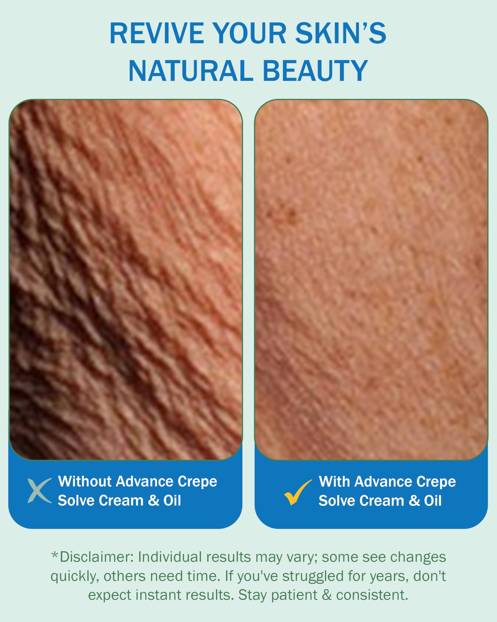 e70 Advanced Firming Oil for Crepe Skin (2 Pk, 4 Fl Oz Each) – Natural Oils, Licorice Root & Chamomile, Made in USA