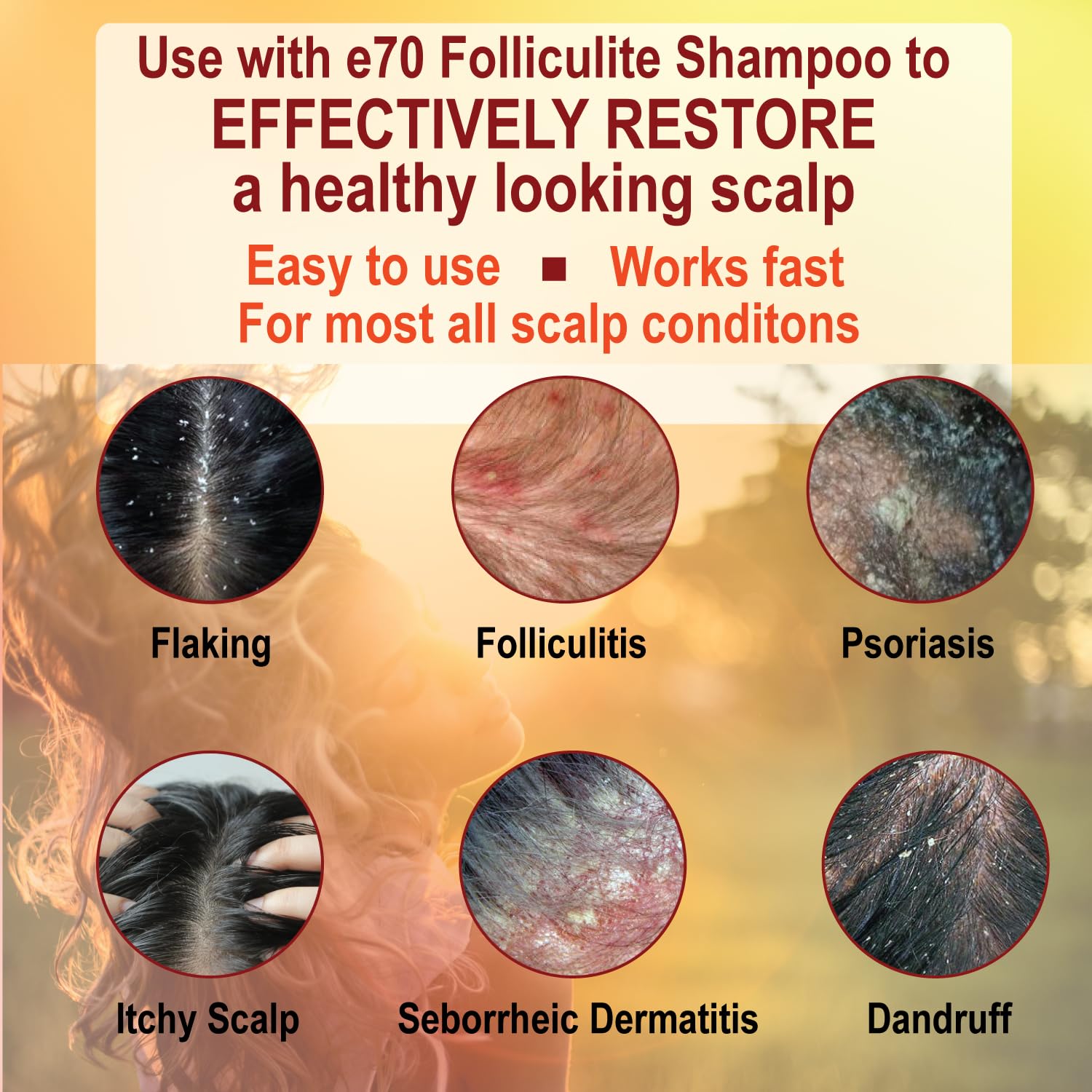 e70 Folliculitis Treatment Conditioner - 3% BHA, Tea Tree & Chamomile, 8 fl oz