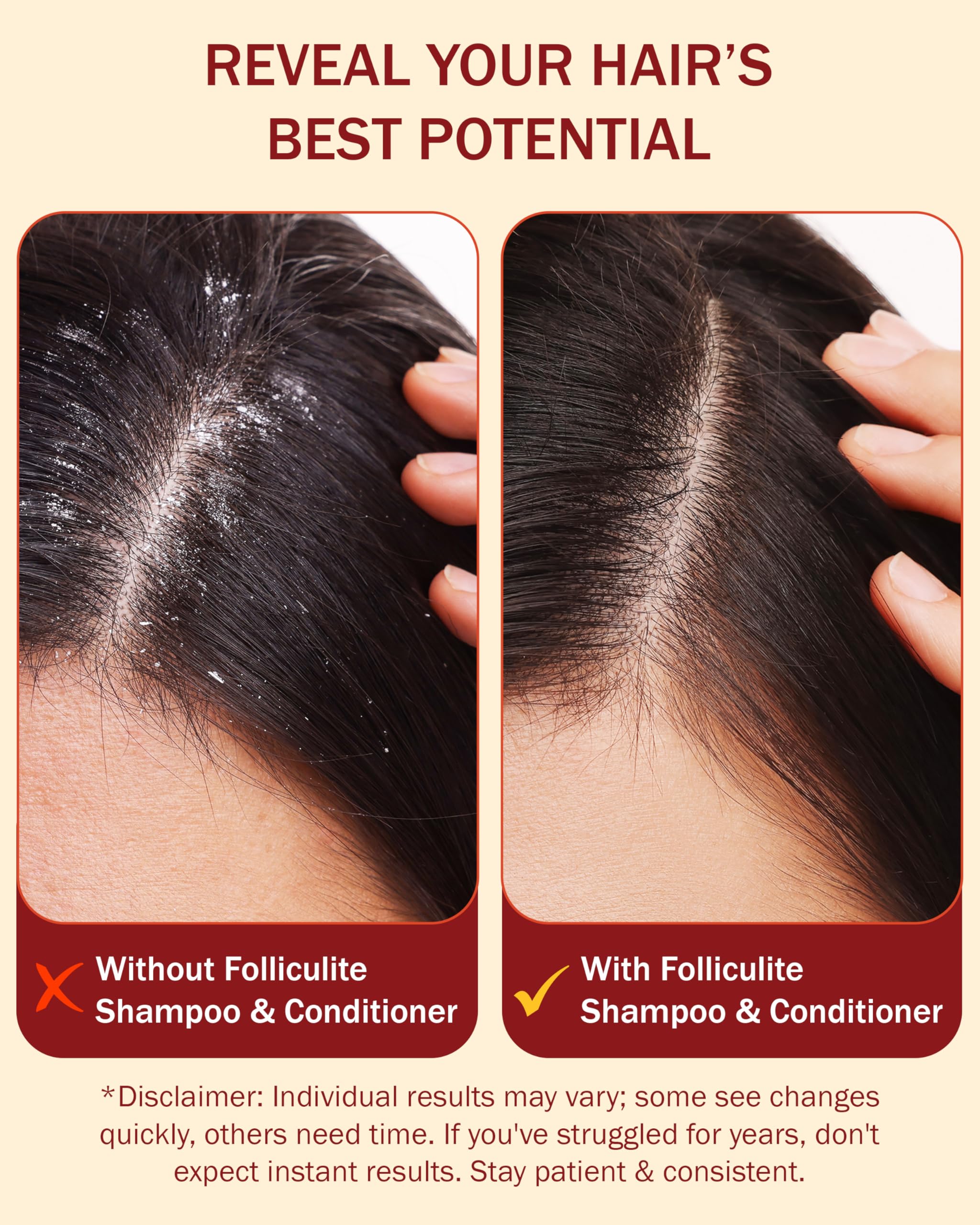 e70 Folliculitis Treatment Shampoo & Conditioner – 3% BHA, Aloe Vera & Tea Tree Oil (8 fl oz) – Made in USA