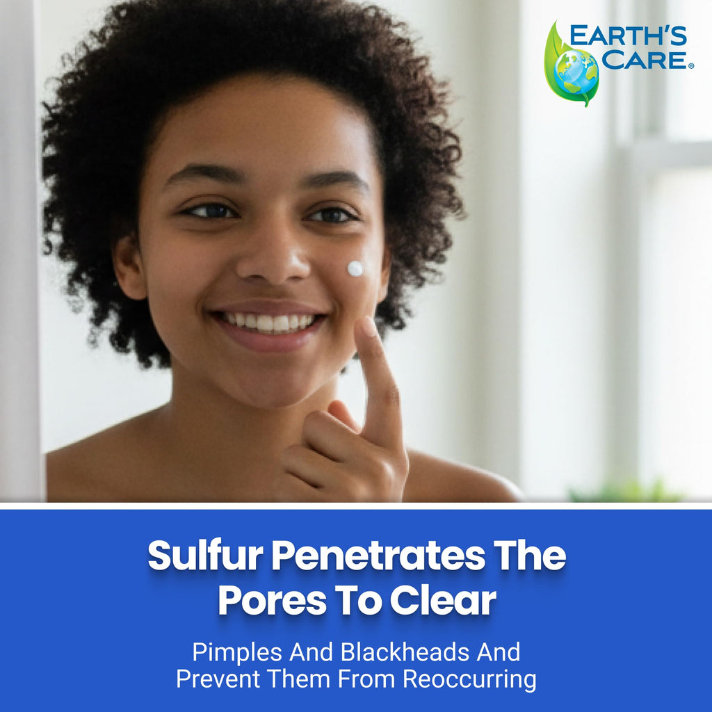 Earth's Care Acne Spot Treatment - 10% Sulfur Cream for Cystic Acne