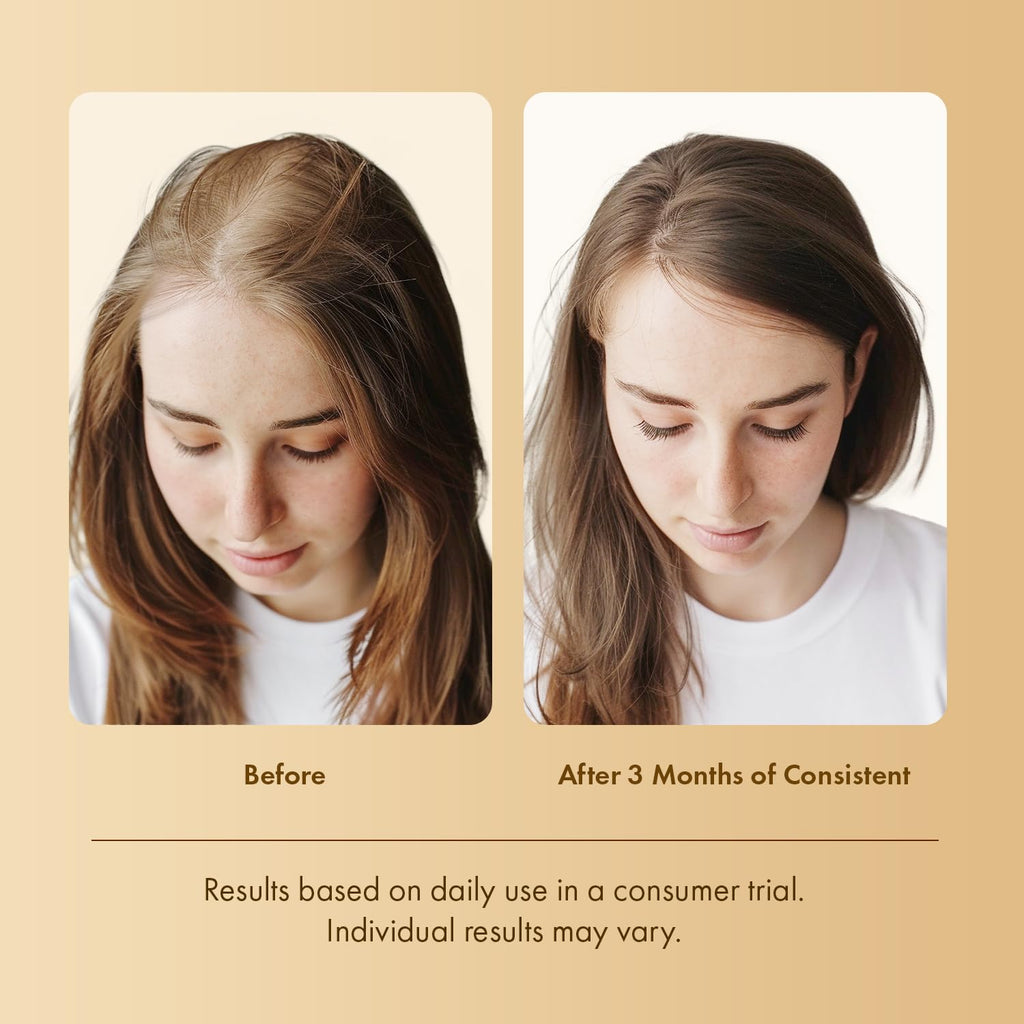 EarthShine Hair Growth Serum Scalp Treatment – Rosemary, Multi-Peptide & Caffeine for Thinning Hair – 2-Pack
