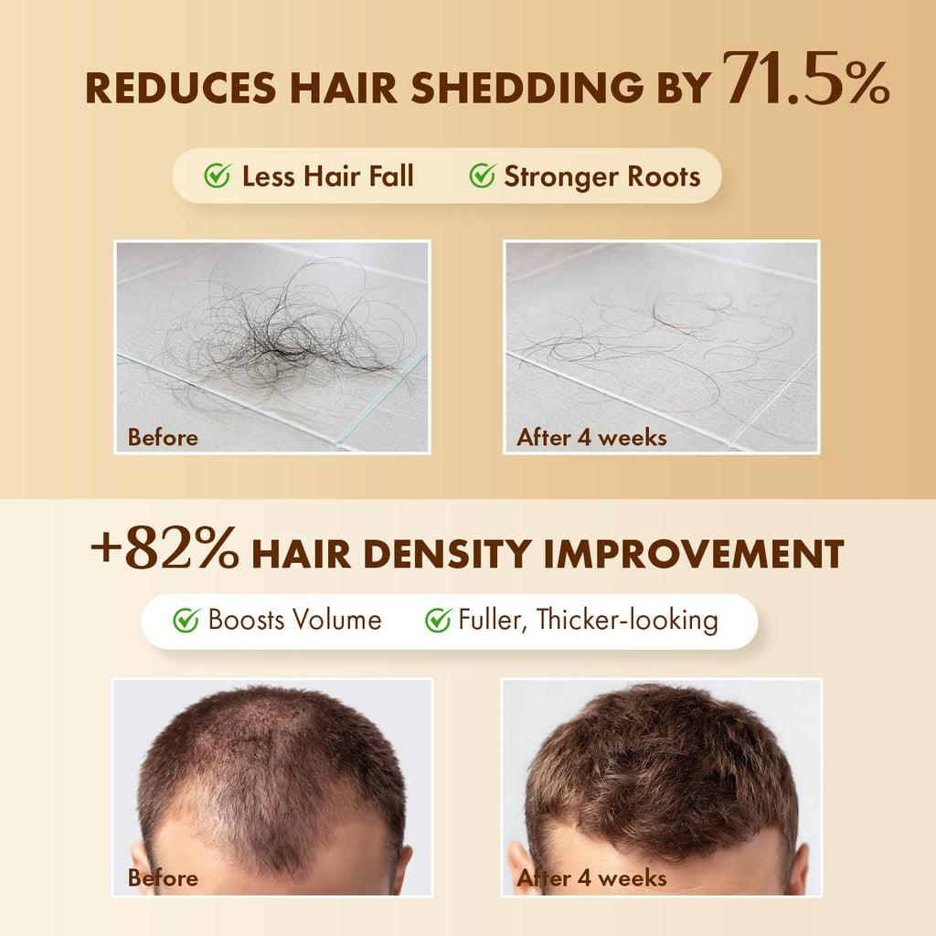 EarthShine Hair Growth Serum Scalp Treatment – Rosemary, Multi-Peptide & Caffeine for Thinning Hair – 2-Pack