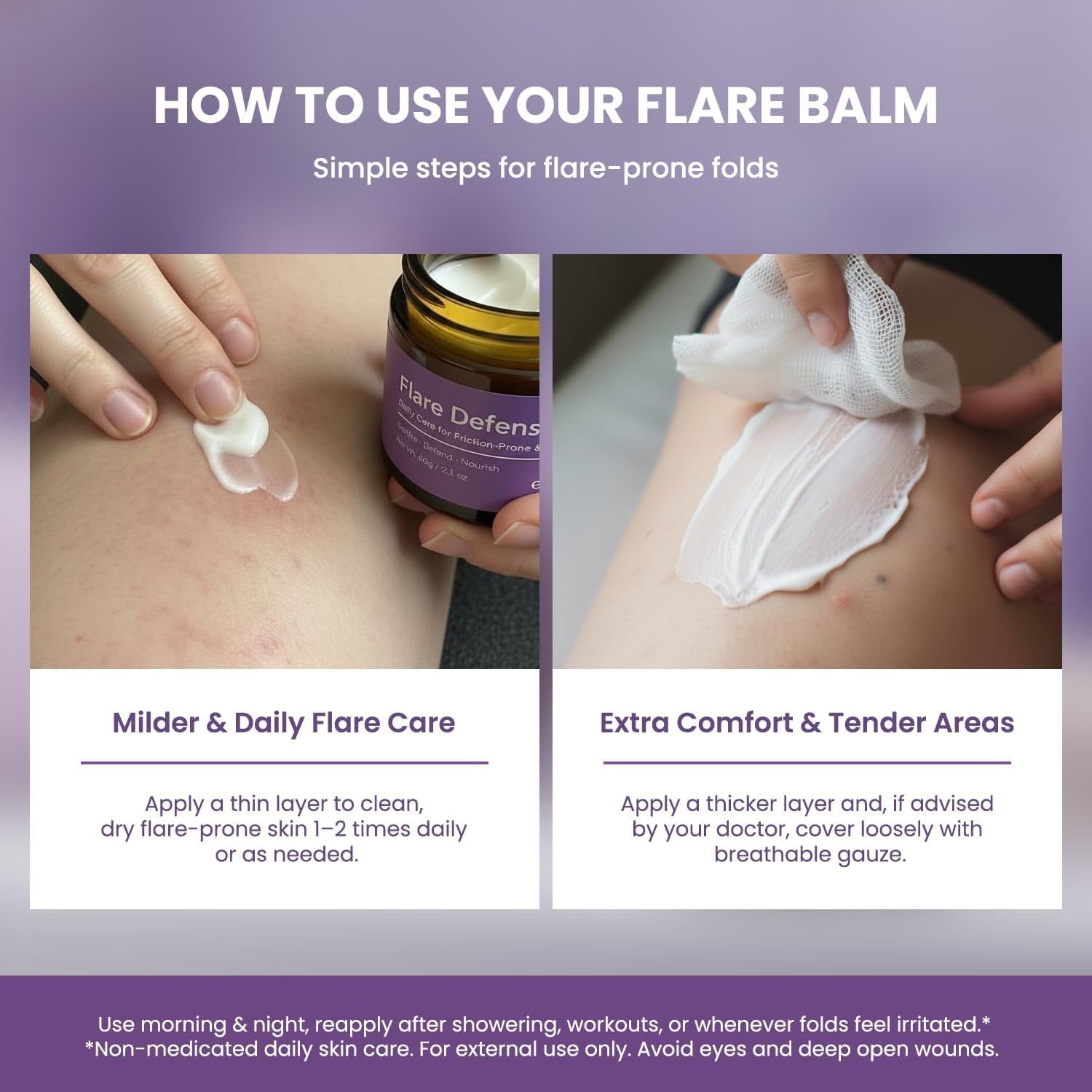 Easment Hidradenitis Suppurativa Flare Defense Balm – Science-Backed HS Care with Microsilver BG, Zinc Oxide & Botanical Blend (2 x 2 oz)