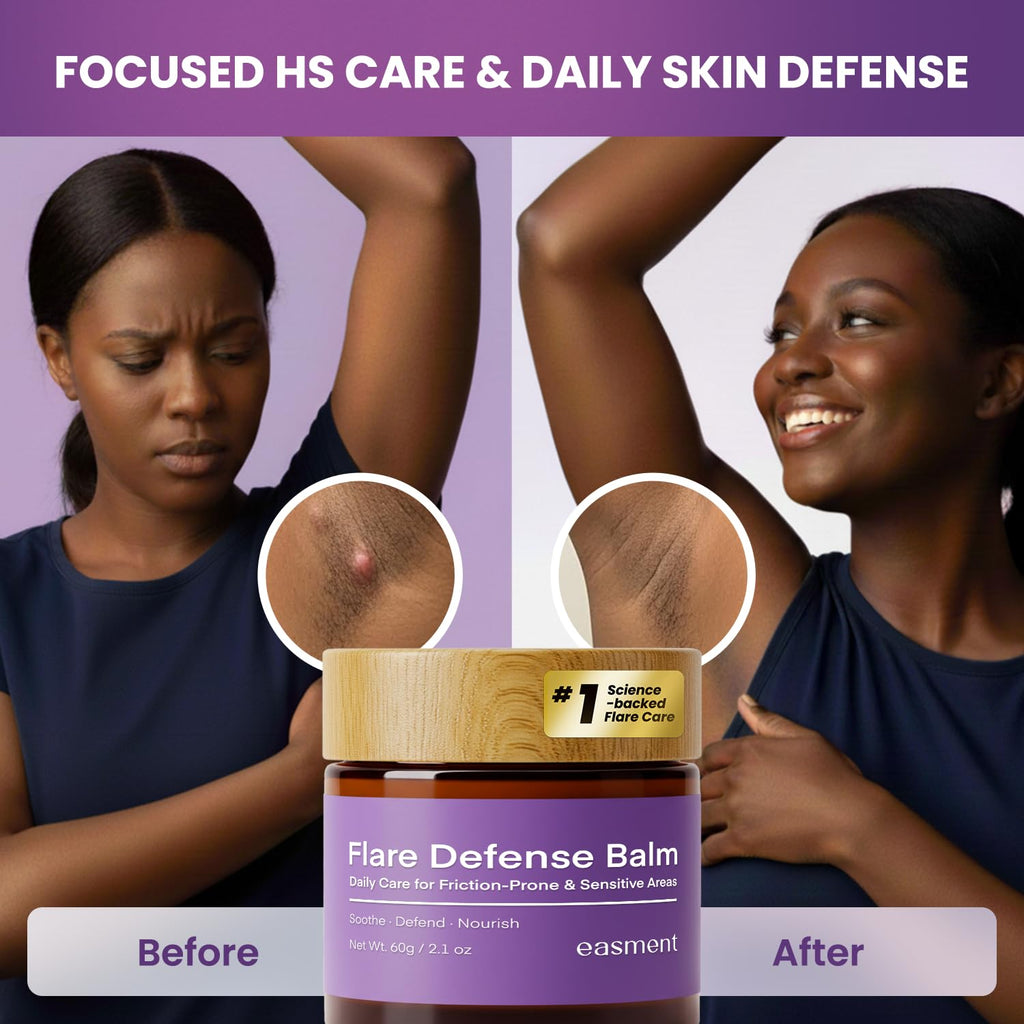 Easment Hidradenitis Suppurativa Flare Defense Balm – Science-Backed HS Care with Microsilver BG, Zinc Oxide & Botanical Blend (2 x 2 oz)