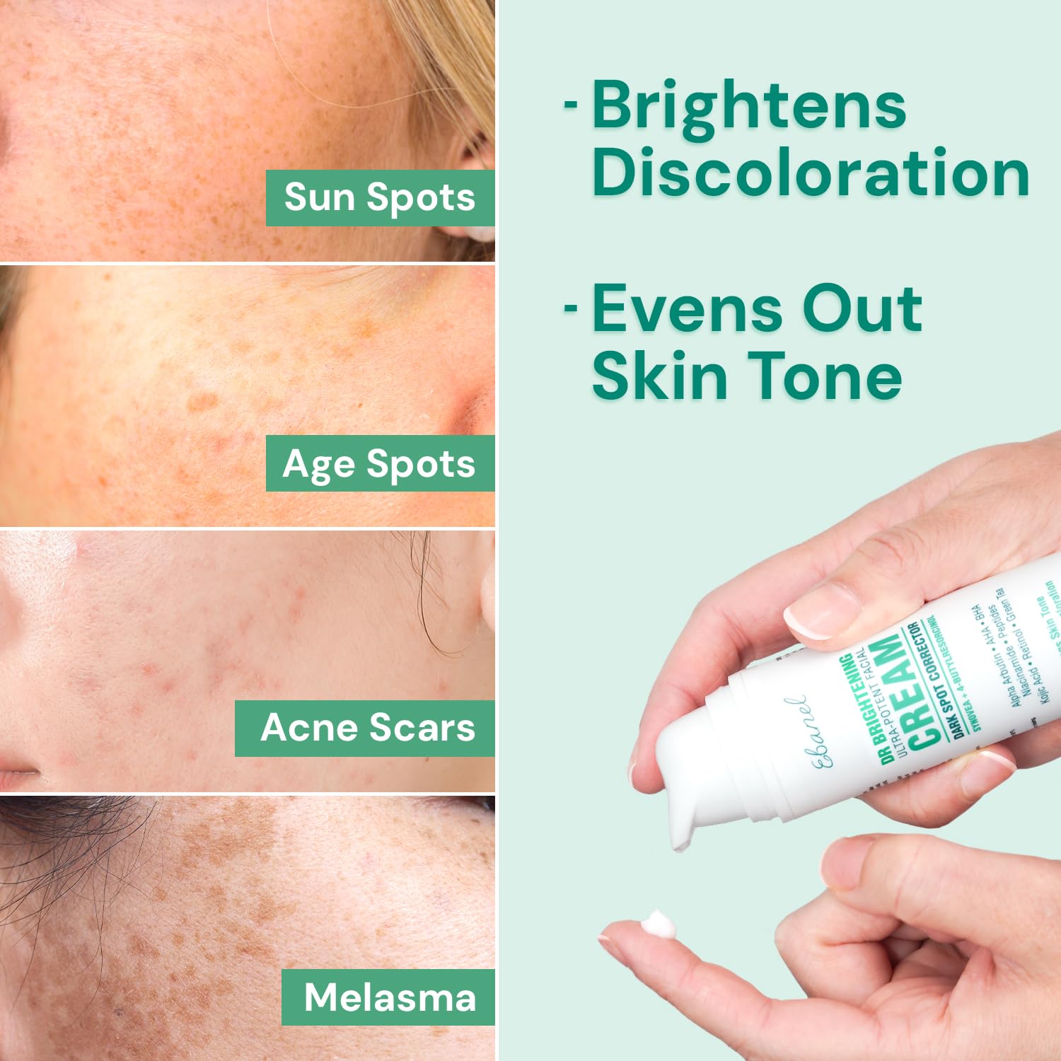 Ebanel Dark Spot Remover for Face & Body — Brightening Cream with Synovea HR