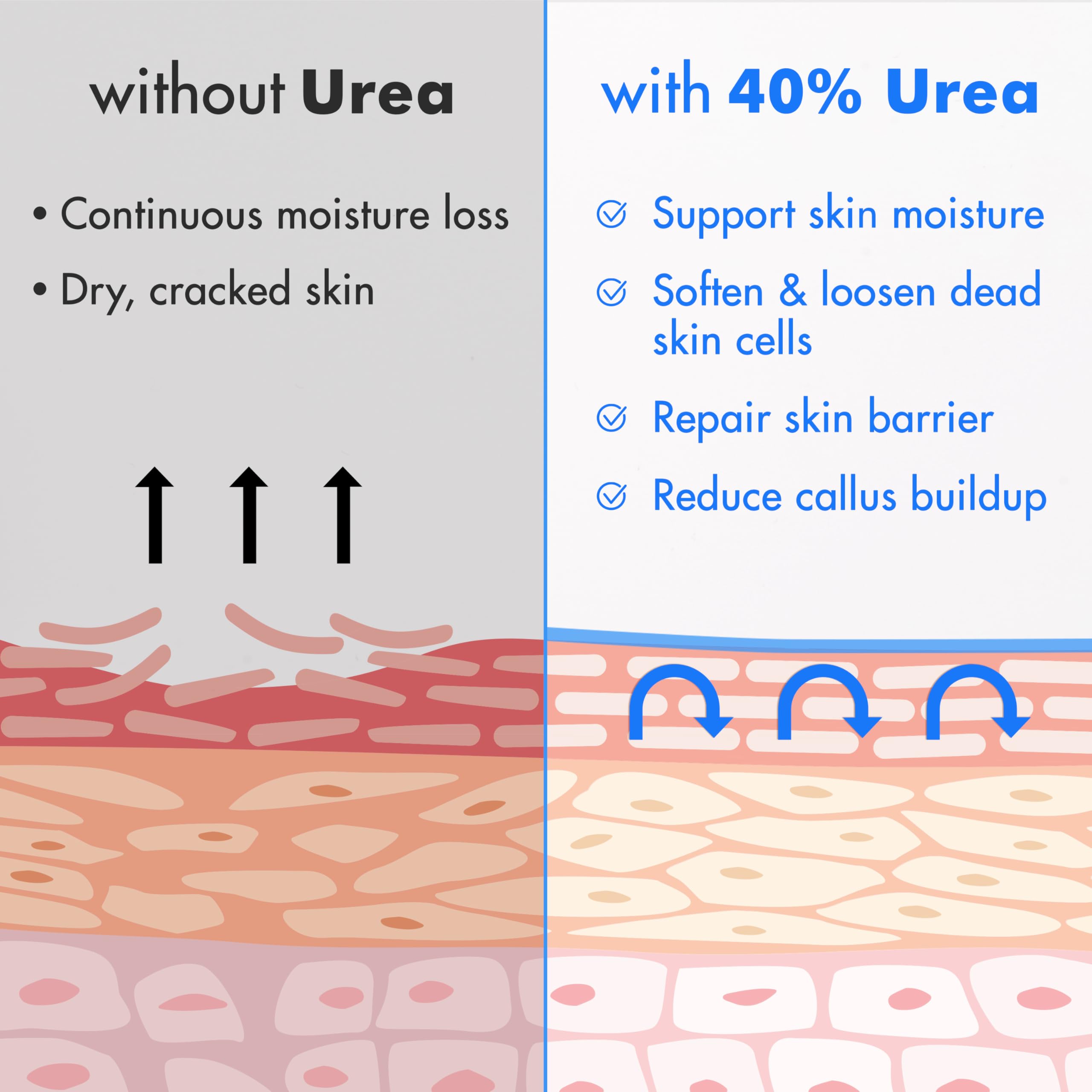 Ebanel Urea Cream 40% + 2% Salicylic Acid – Foot & Skin Keratolytic Care (2-Pack)