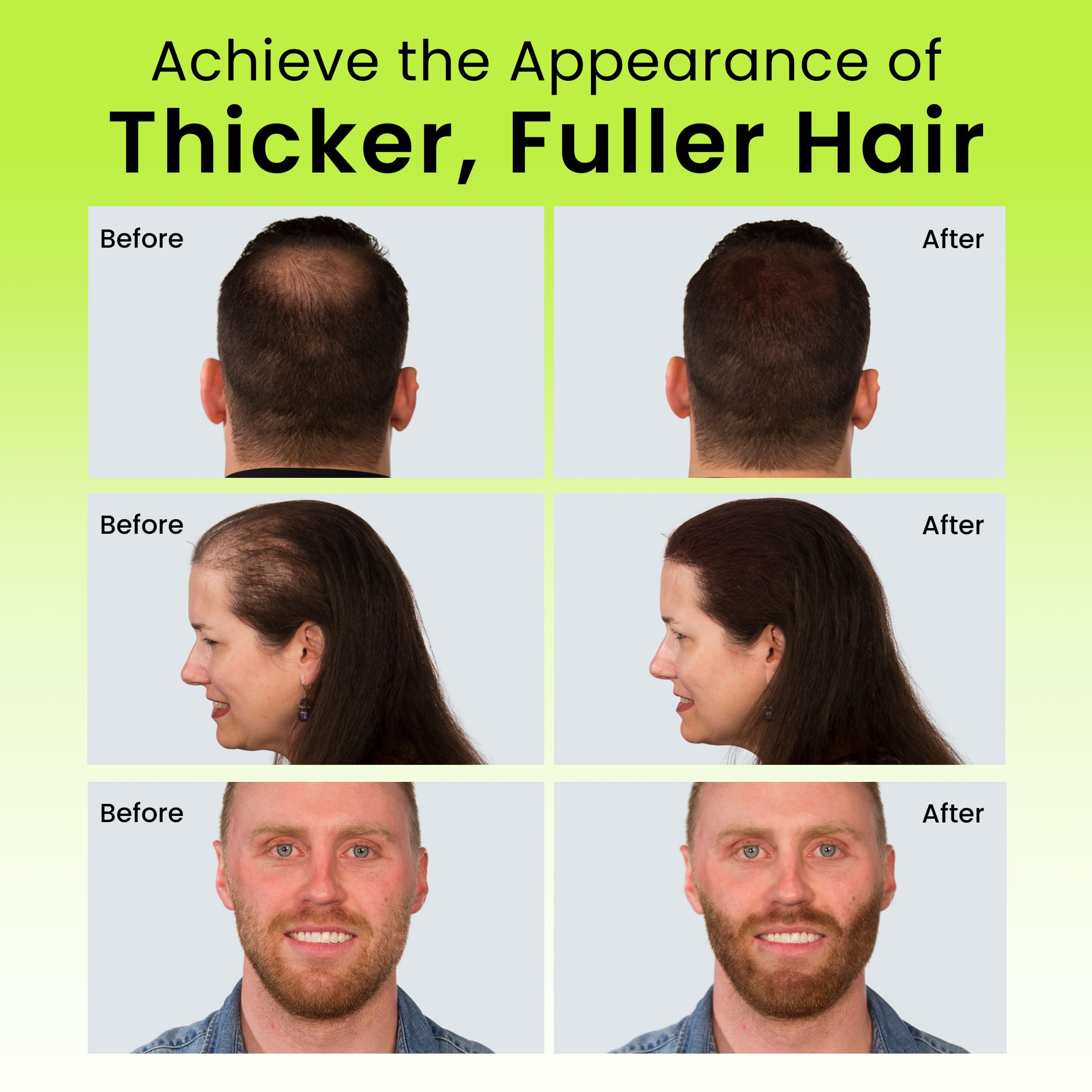 Eclipse Hair Fibers Dark Blonde – 30g Instant Thinning Hair Concealer for Women & Men