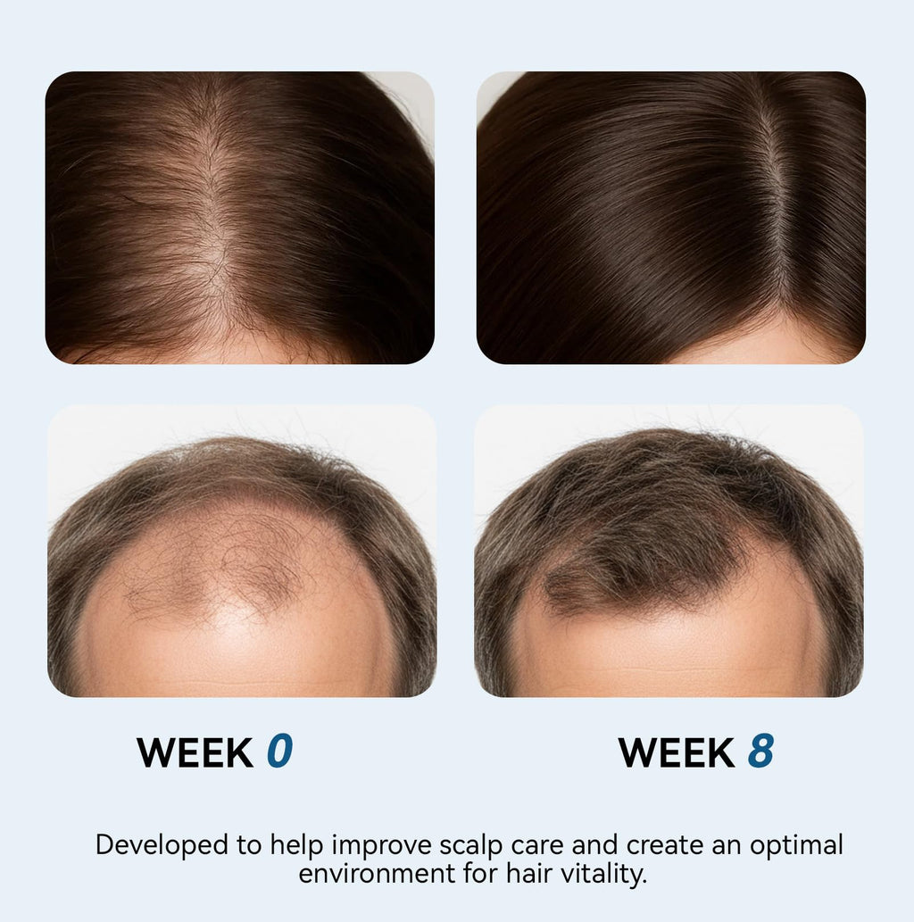 EELHOE Rosemary Hair Growth Serum Roll-On – 25 ml | 3% Rosemary, 2% Ginger, 3% Aloe | Paraben & Sulfate-Free