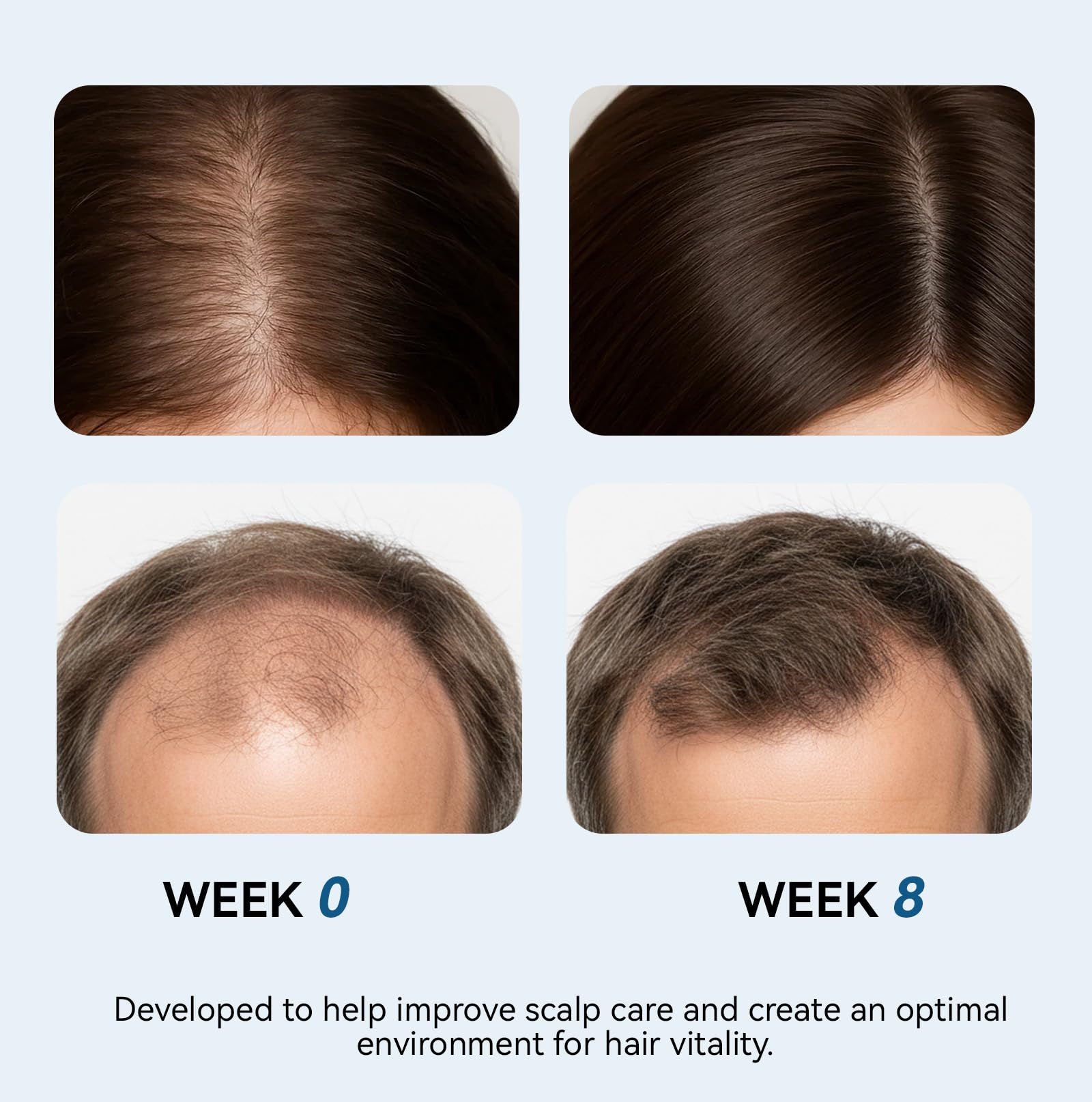 EELHOE Rosemary Hair Growth Serum Roll-On – 25 ml | 3% Rosemary, 2% Ginger, 3% Aloe | Paraben & Sulfate-Free
