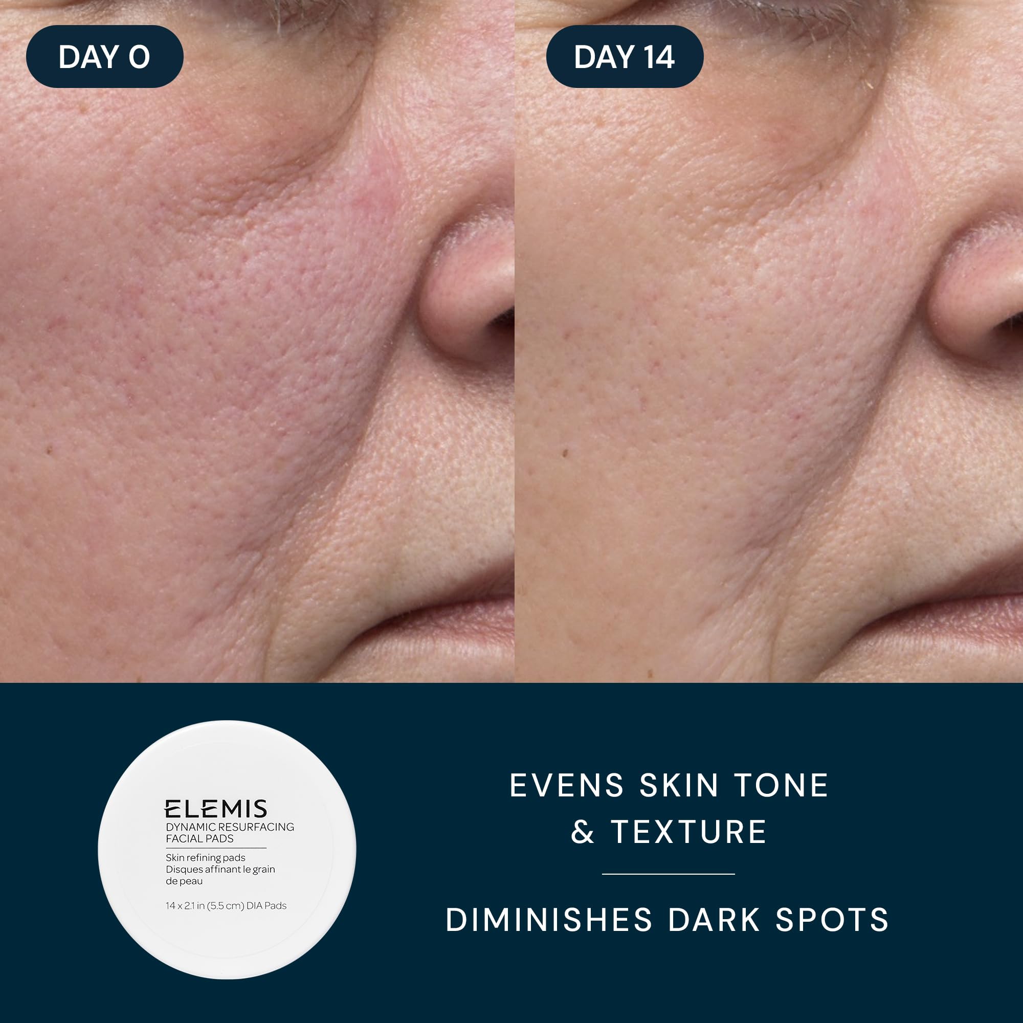 ELEMIS Healthy Skin Travel Set | Pro-Collagen Cleansing Balm Mini, Marine Cream SPF 30 Mini & Dynamic Resurfacing Pads