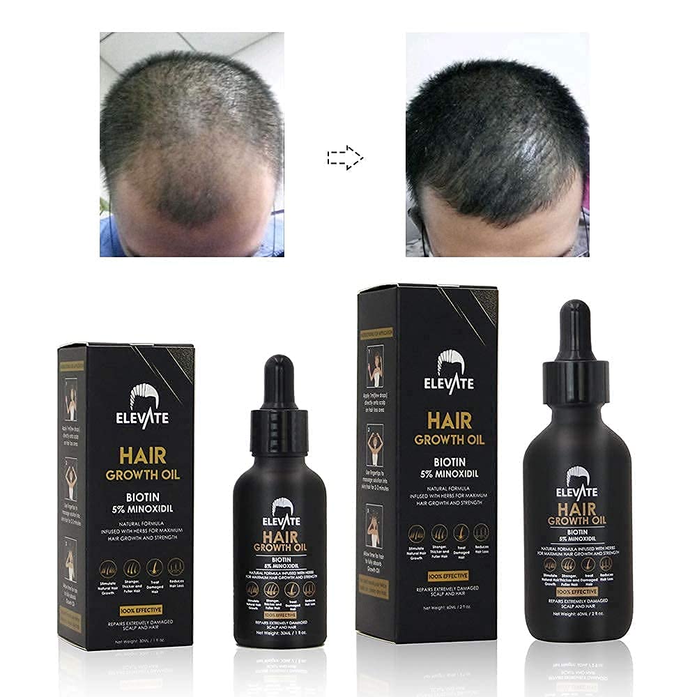 Elevate Hair Regrowth Treatment 5% Minoxidil with Biotin Serum – Thicker, Fuller Hair for Men & Women