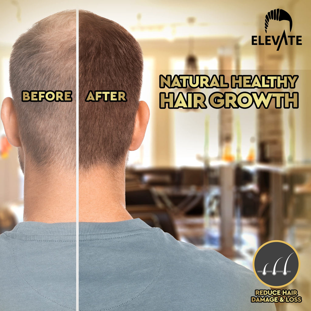 Elevate Hair Growth Oil – Biotin Serum & Castor Oil for Stronger, Fuller Hair | 1 Fl Oz