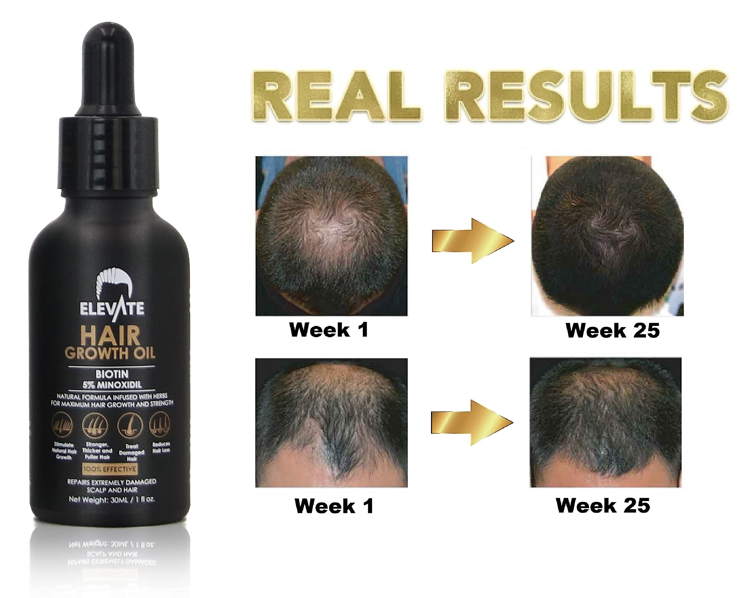 Elevate Hair Regrowth Treatment 5% Minoxidil with Biotin Serum – Thicker, Fuller Hair for Men & Women