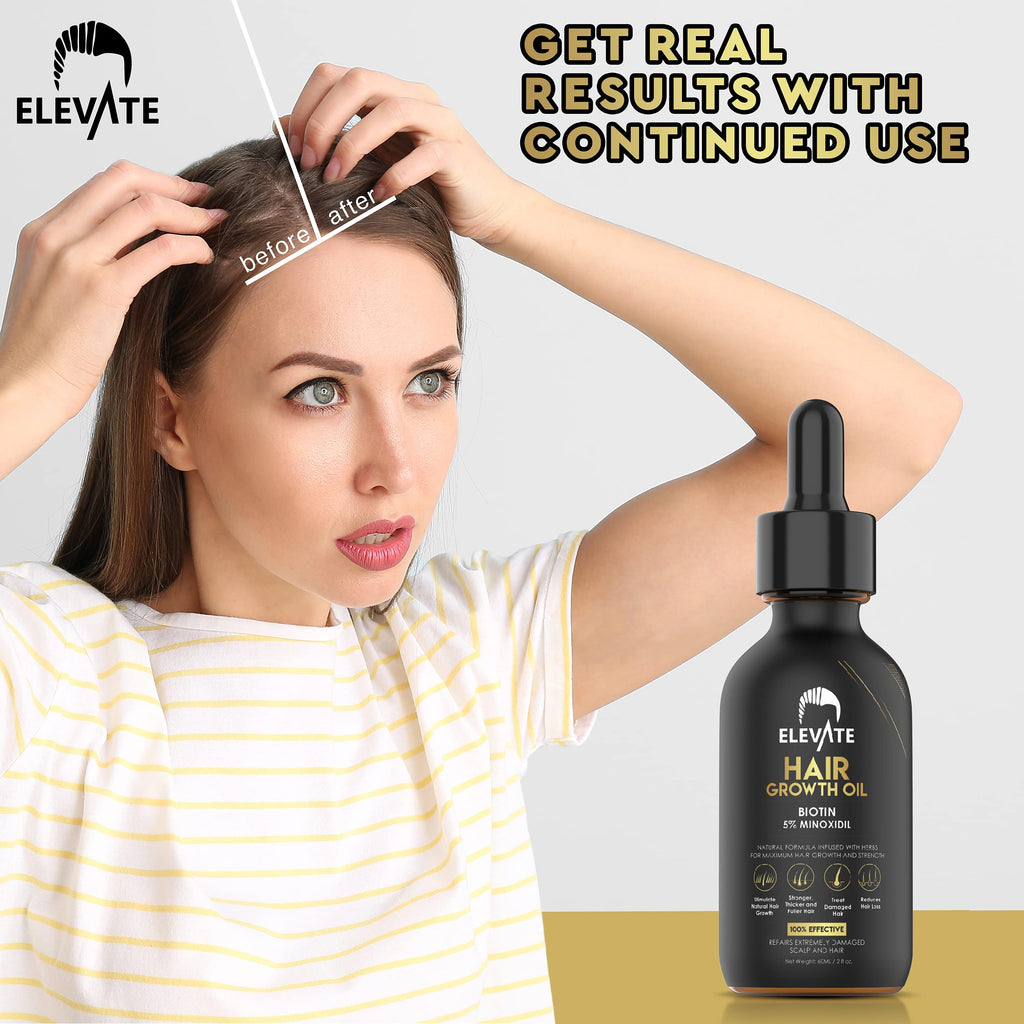 Elevate Hair Regrowth Treatment 5% Minoxidil with Biotin Serum – Thicker, Fuller Hair for Men & Women