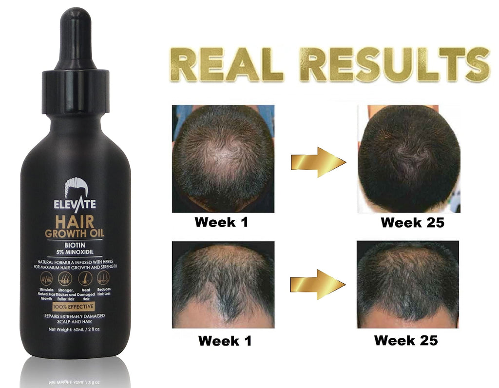 Elevate Hair Regrowth Treatment 5% Minoxidil with Biotin — Fuller, Thicker Hair (2oz)