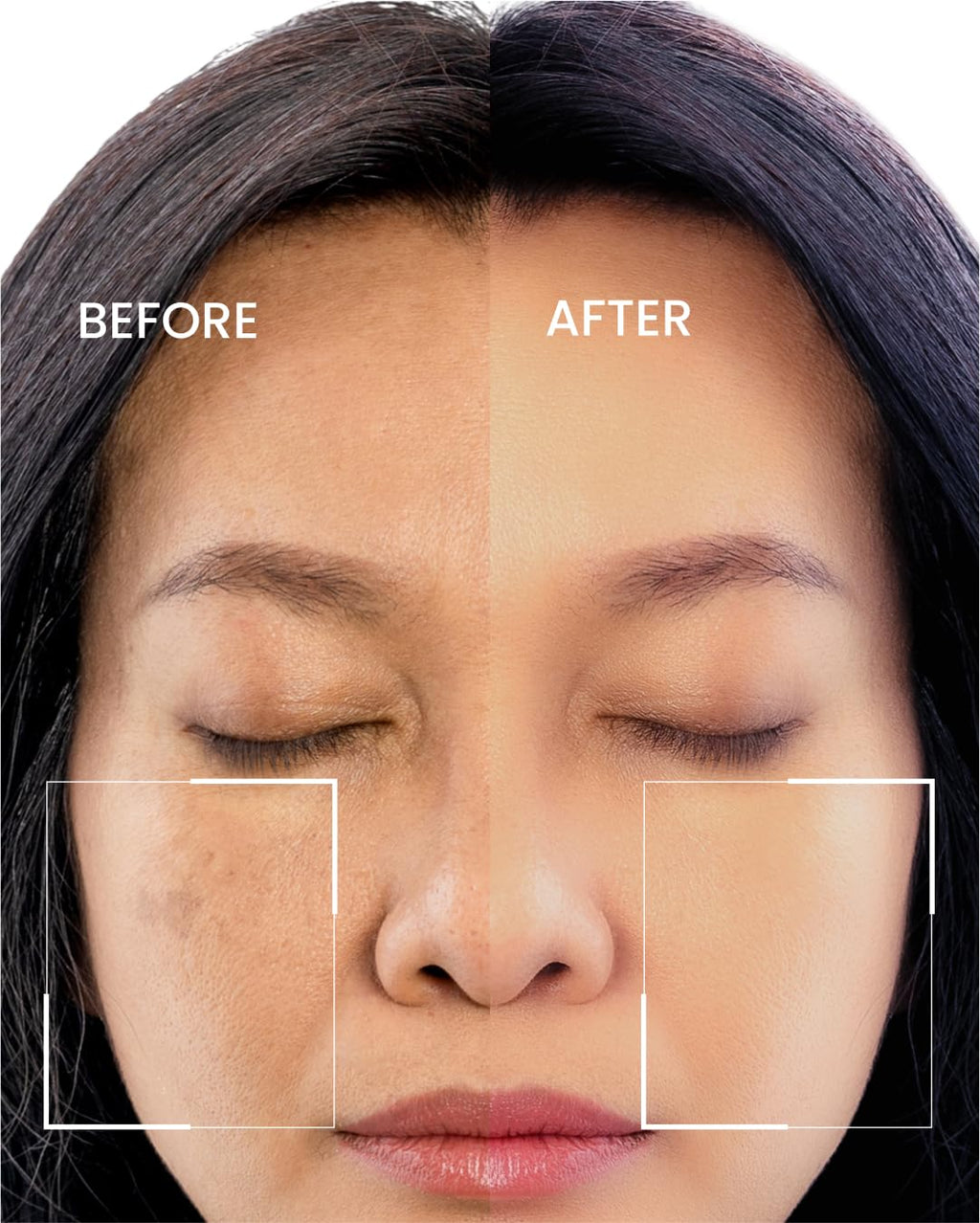 Eliré Radiance & Renewal Serum – HA, Vitamin C & Kojic Acid | 30ml
