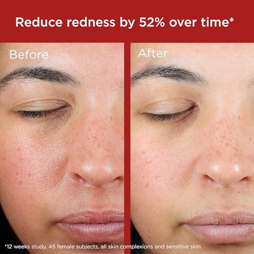 EltaMD UV Skin Recovery SPF 50 – All Mineral Zinc Oxide Sunscreen for Sensitive Skin