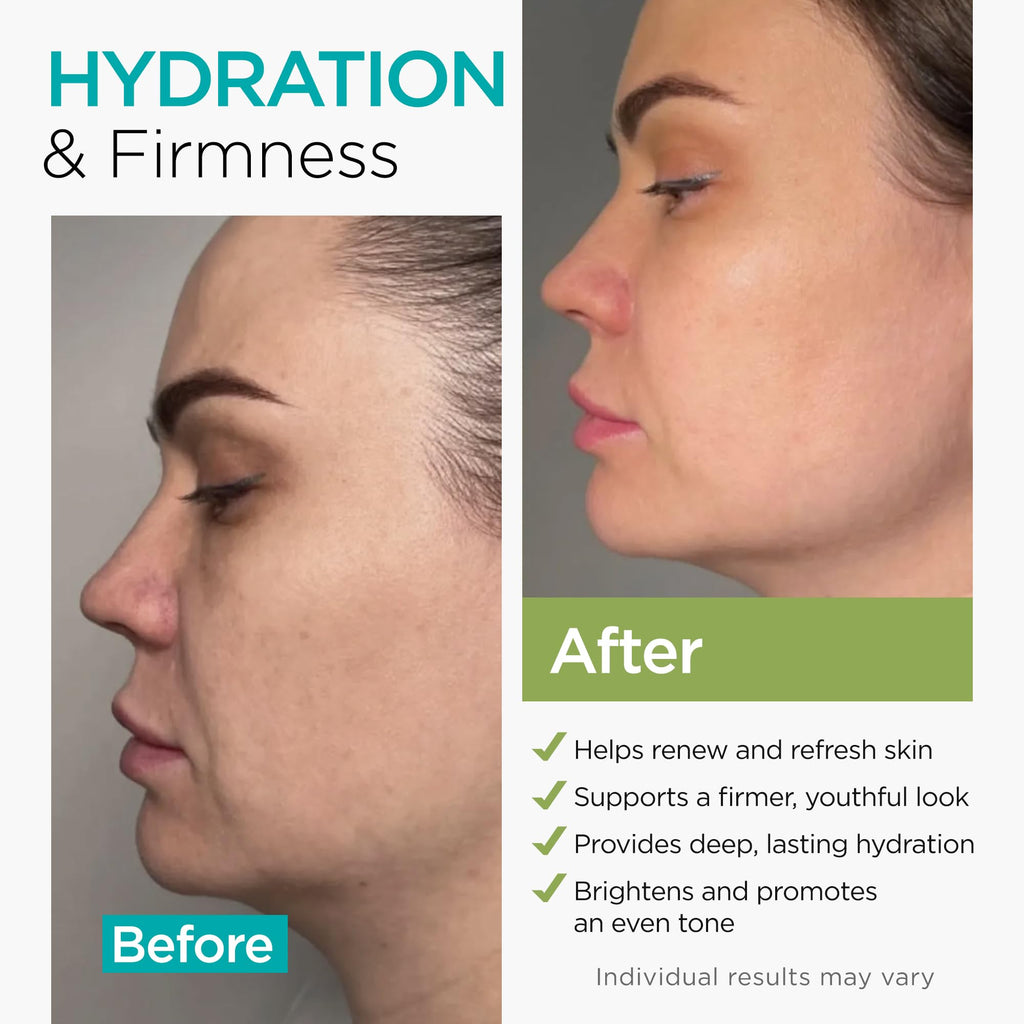 Ember Cloud Collagen NAD+ Cream – Day & Night Face Moisturizer with Retinol, Hyaluronic Acid & Niacinamide | Made in USA