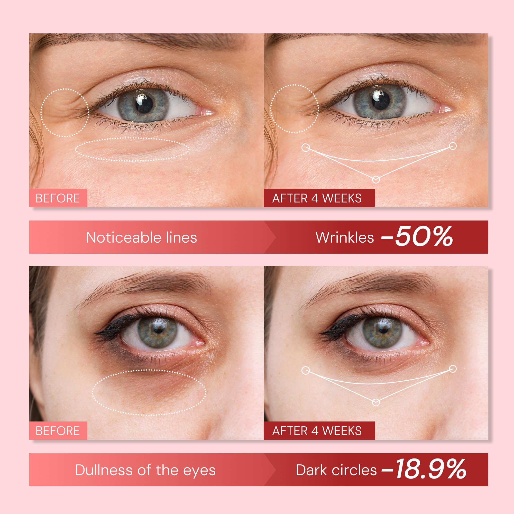 Enaskin Naturals Retinol Eye Cream – Anti-Aging Eye Tightener, Dark Circles & Puffiness, 0.85 fl oz