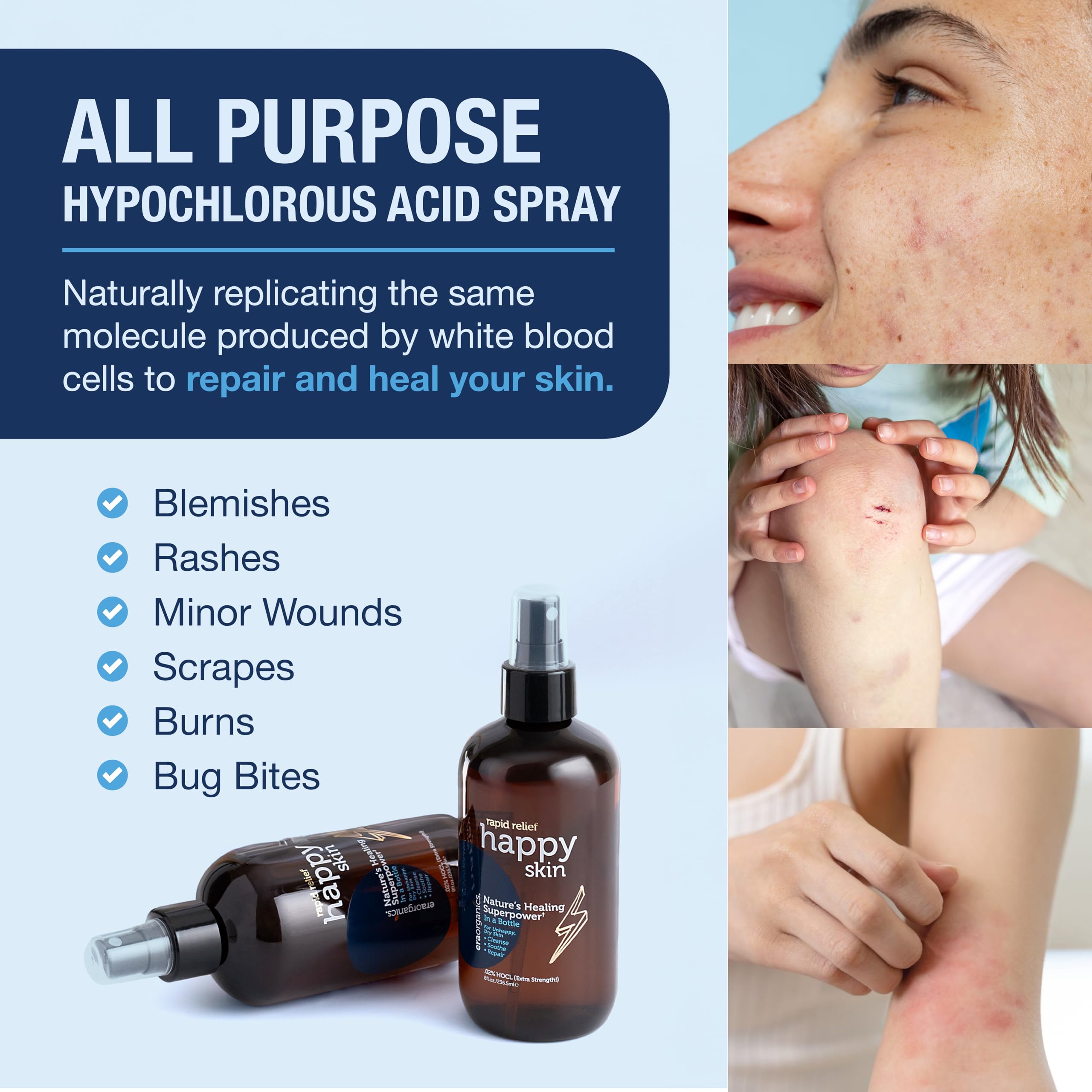 Era Organics Happy Skin HOCl Toner Spray .02% – Extra Strength, Extra Gentle, 8oz