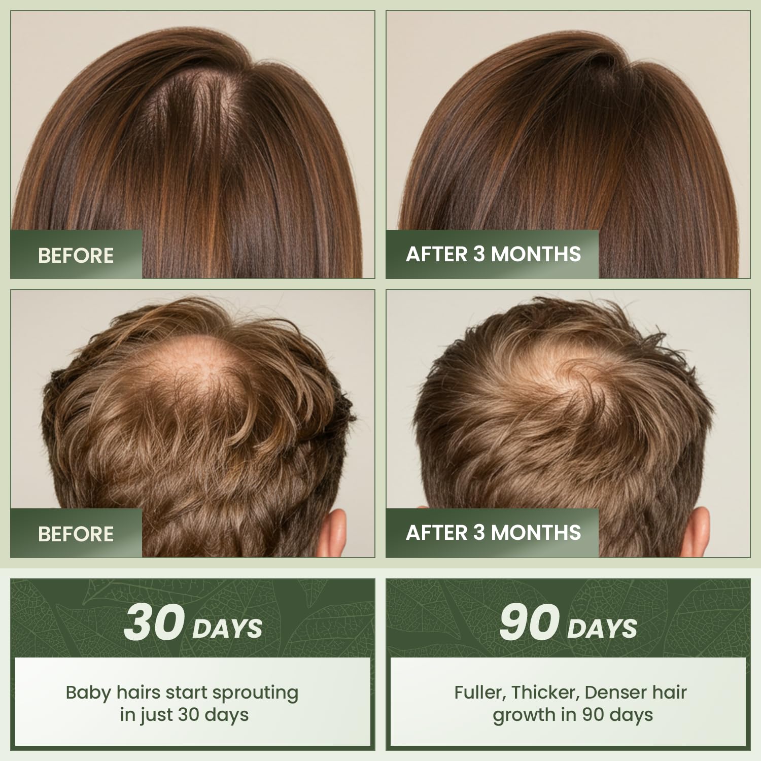 EssyNaturals Advanced Hair Growth Oil with Biotin – Caffeine & Castor Oil for Fuller, Thicker, Longer Hair