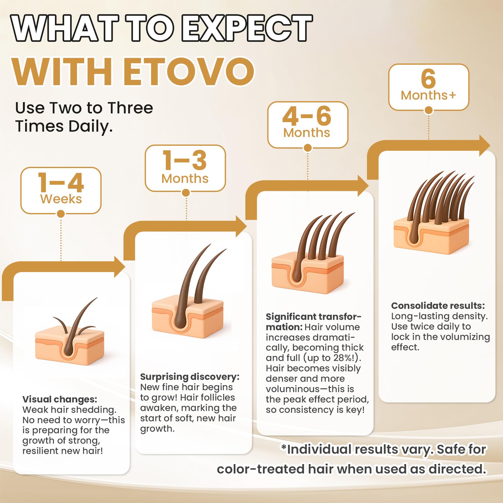 ETOVO 5% Minoxidil for Women – Hair Growth Serum for Thicker, Fuller Hair