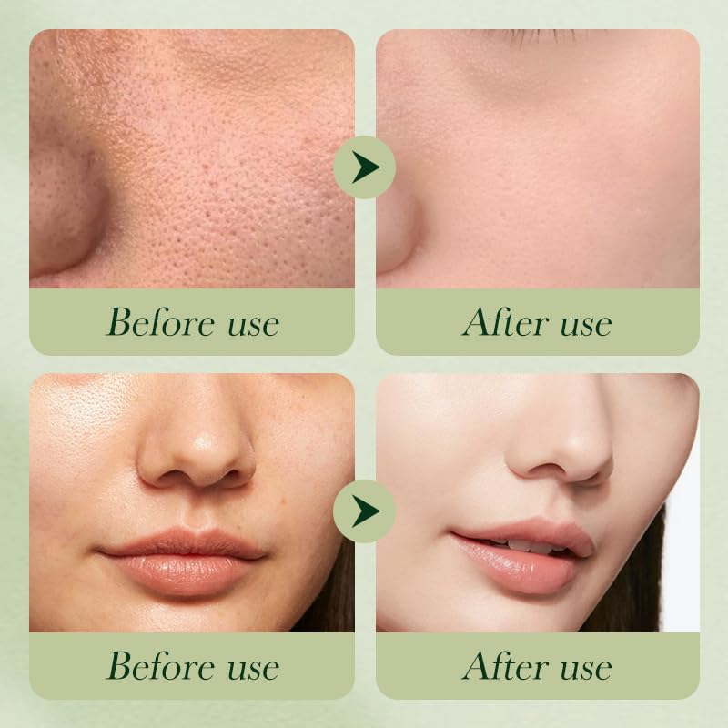 Etuanxi Avocado Skincare Set – 6-Piece Gift Kit (Cleanser, Serum, Moisturizer)