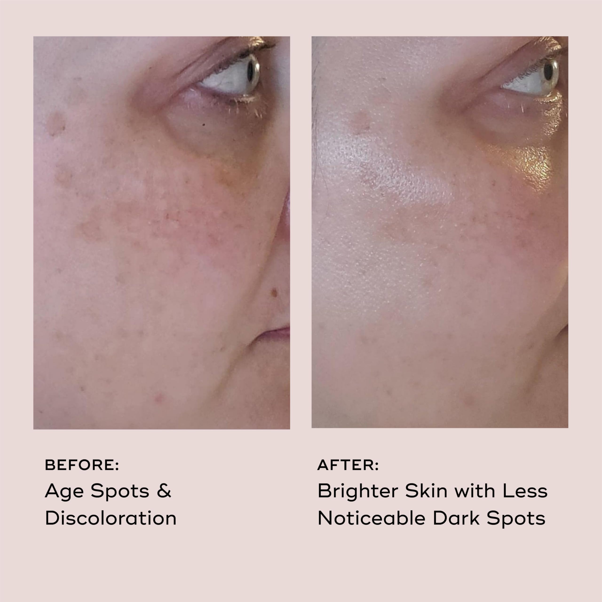 EVER Vitamin C Dark Spot Serum – Brightening, Anti-Aging, 10% Vitamin C | 1 oz