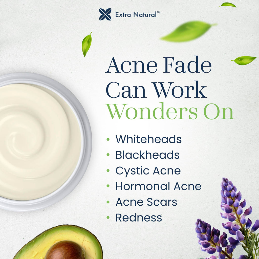 ExtraNatural Acne Cream – Gentle, Plant-Powered Care for Sensitive & Oily Skin