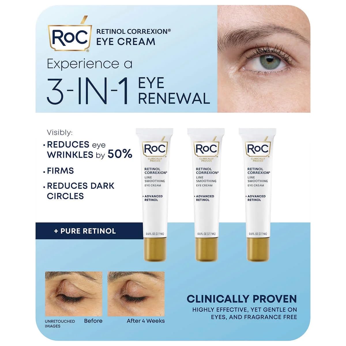 Eye See RoC Line Smoothing Eye Cream, 0.6 fl oz (Pack of 3)