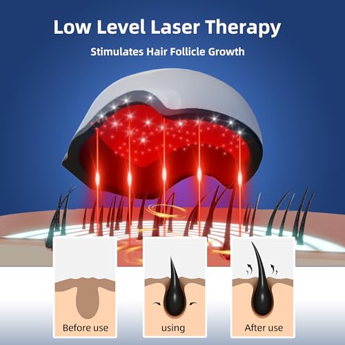 faq101 Hair Growth Device with Laser Red Light Therapy – FDA Cleared