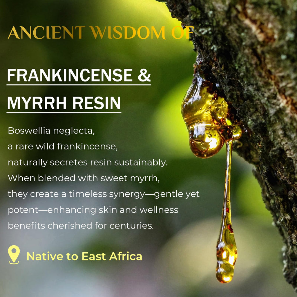FeeMeFee Frankincense Balm 2oz – Soothing Moisturizer with Myrrh, Boswellia Serrata & Nutrient Oils