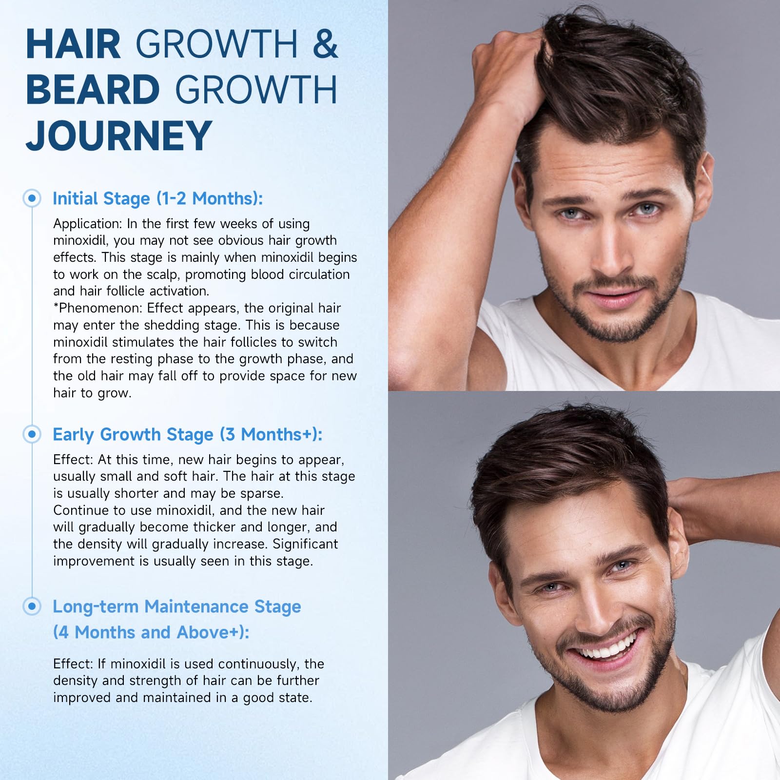 Felicemy 5% Minoxidil Spray for Hair & Beard Growth — Men & Women, 3.38 Fl Oz