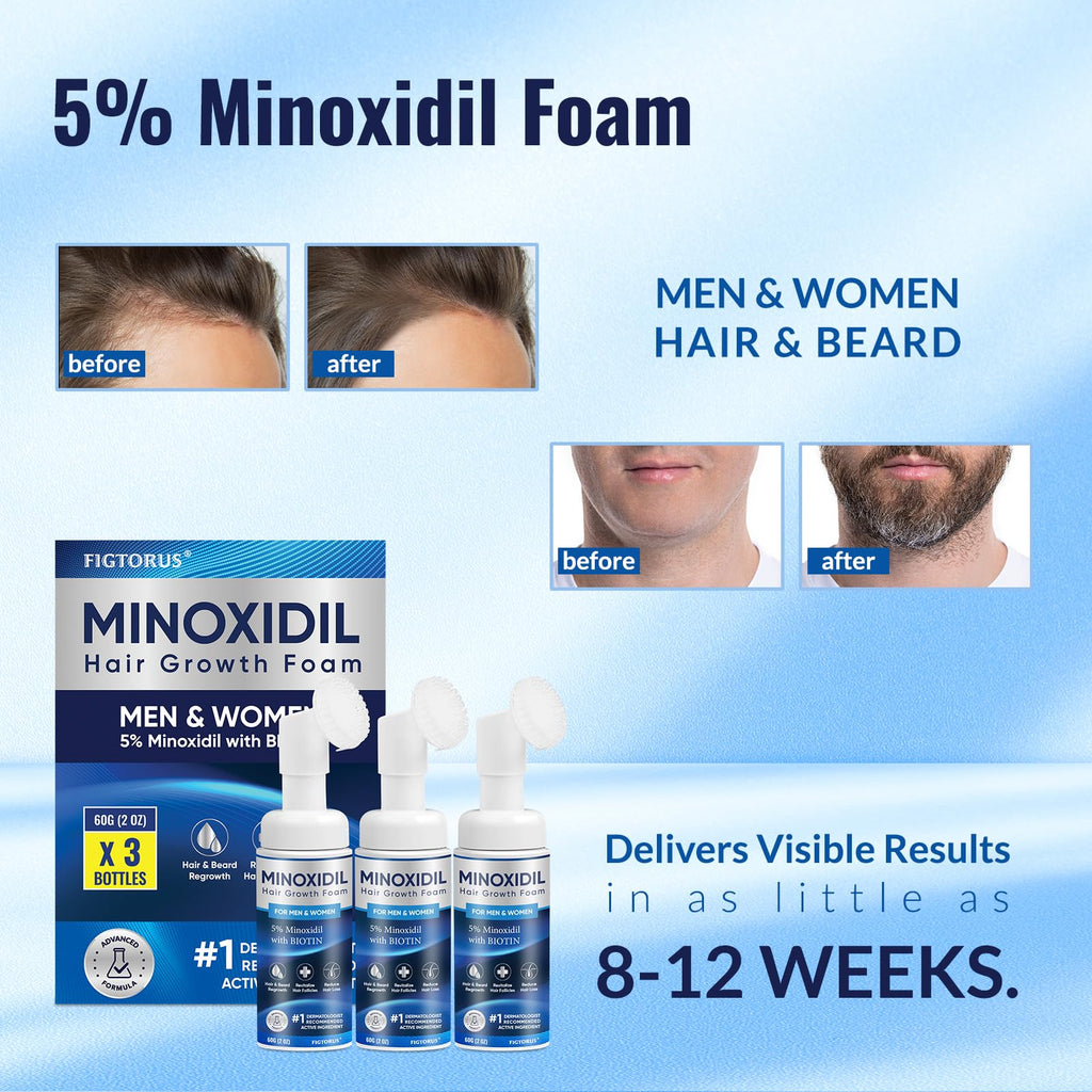 FIGTORUS 5% Minoxidil Foam for Men & Women – 6 oz