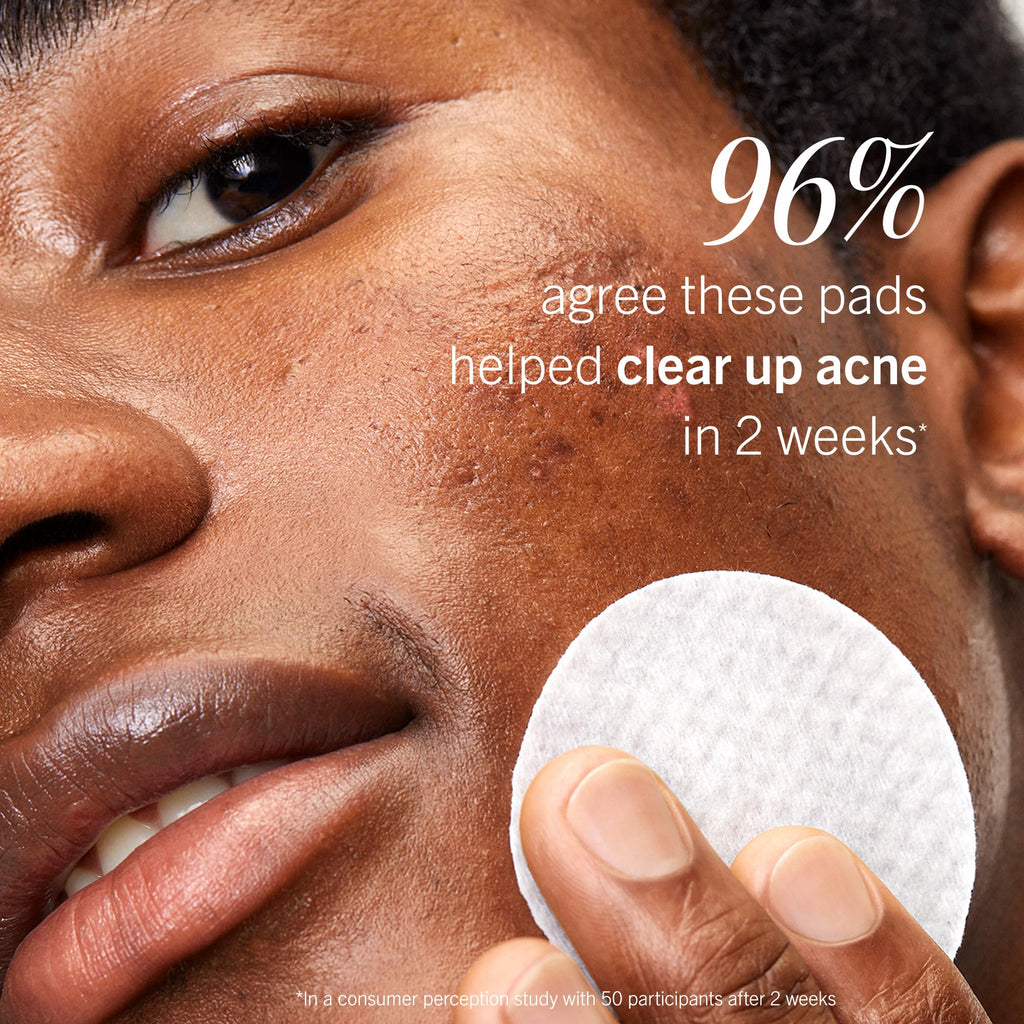 First Aid Beauty Acne Pads – 2% Salicylic Acid, Maximum Strength (60-ct)