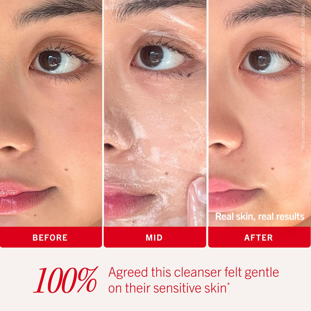 First Aid Beauty Ultra Gentle Cream-to-Foam Cleanser – Makeup Remover & Facial Cleanser, 10 oz