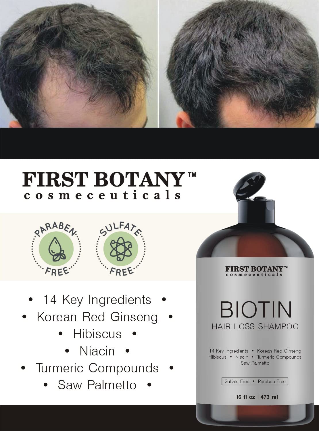 First Botany Cosmeceuticals Hair Regrowth Shampoo – DHT Blockers, Hydration & Volume (Pack of 2)