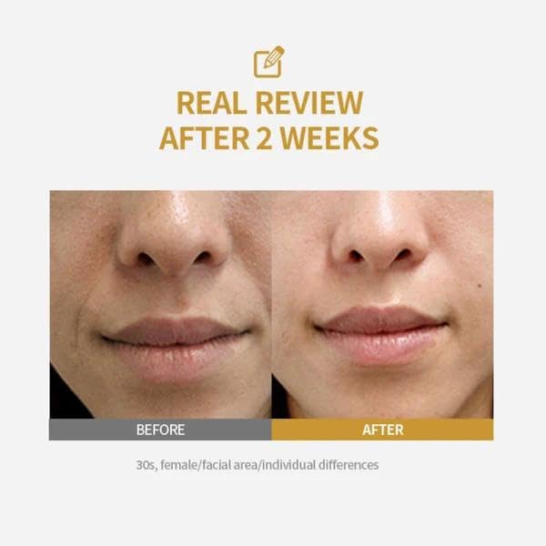 Fneute Silk Peptide Intensive Lifting Ampoule | Moisturizes, Firms & Lifts | Korean Anti-Aging Facial Essence 50ml