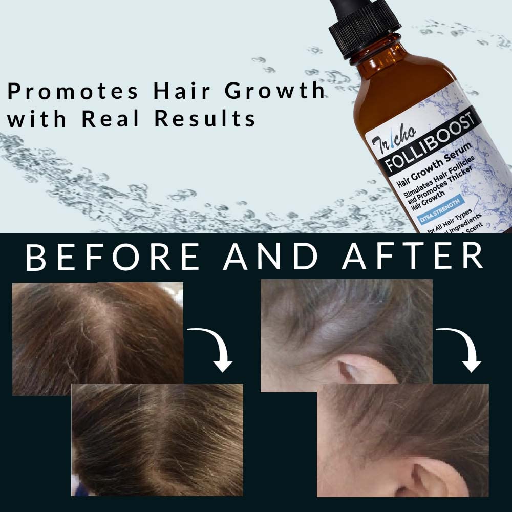 Tricho Labs Folliboost Hair Growth Serum – Natural-Based Formula with Biotin & Peppermint Oil – Thicker, Fuller Hair – 2oz, 6-Pack