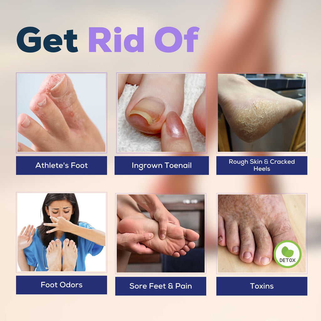 FOOT CURE Premium Epsom Salt Foot Soak with Tea Tree Oil — Pack of 4