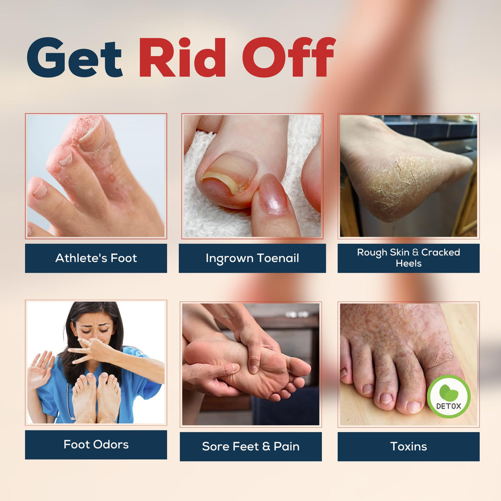 FOOT CURE Tea Tree Oil & Muscle Foot Soak with Epsom Salts – All-Natural Foot Care (Pack of 2)